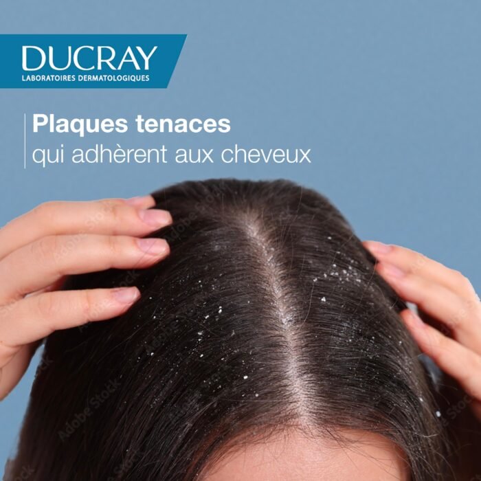 ducray Kelual Squanorm Shampooing Pellicules